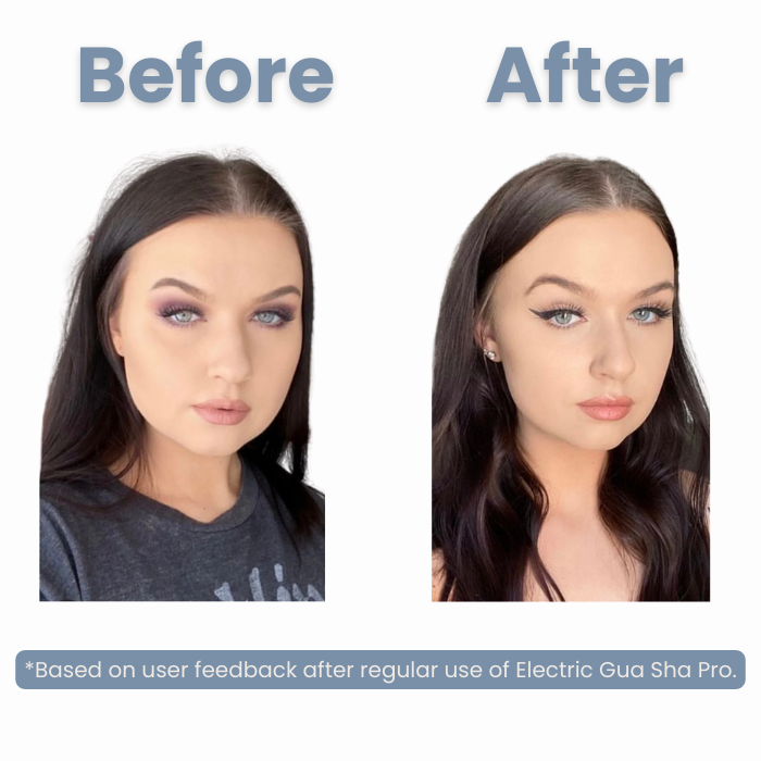 Electric Gua Sha Pro