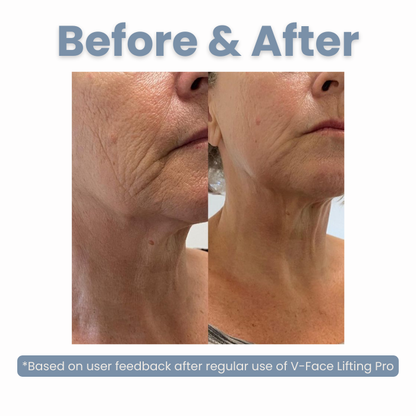 V-Face Lifting Pro