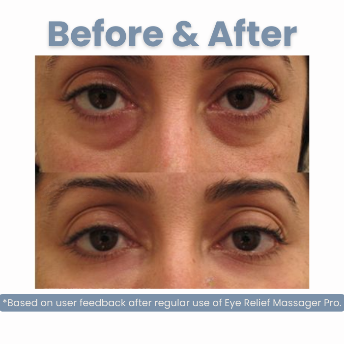 Eye Relief Massager Pro