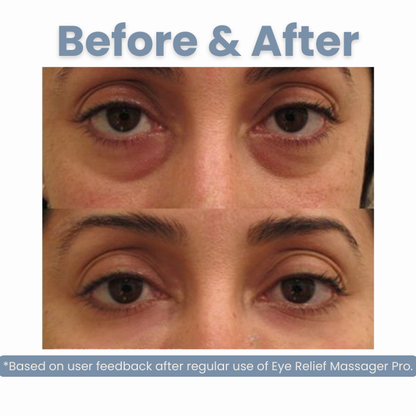 Eye Relief Massager Pro