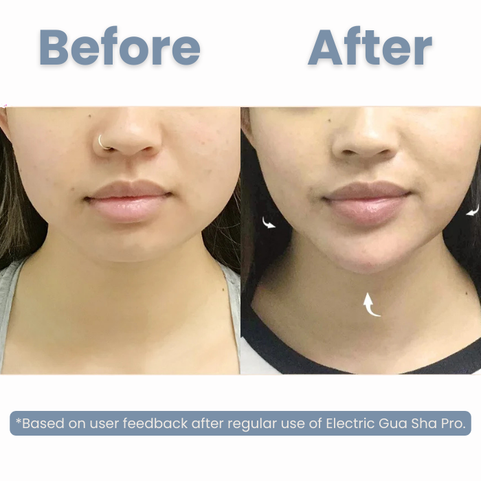 Electric Gua Sha Pro