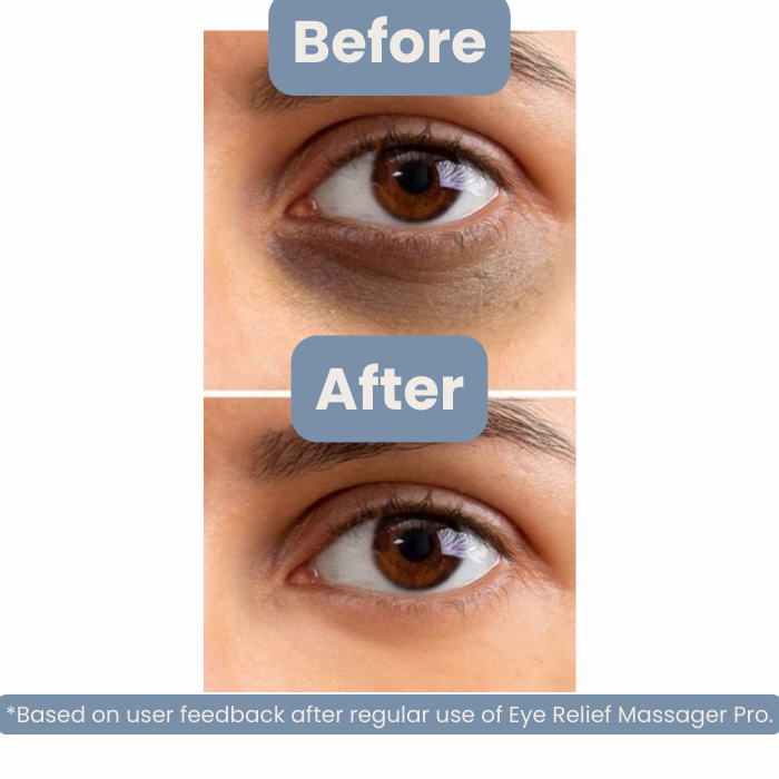 Eye Relief Massager Pro