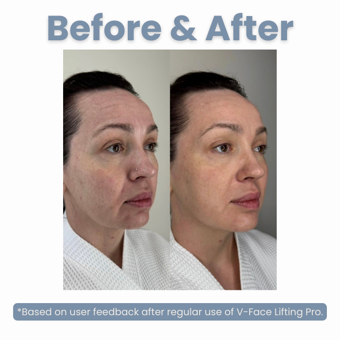 V-Face Lifting Pro