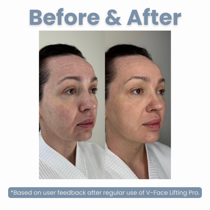 V-Face Lifting Pro